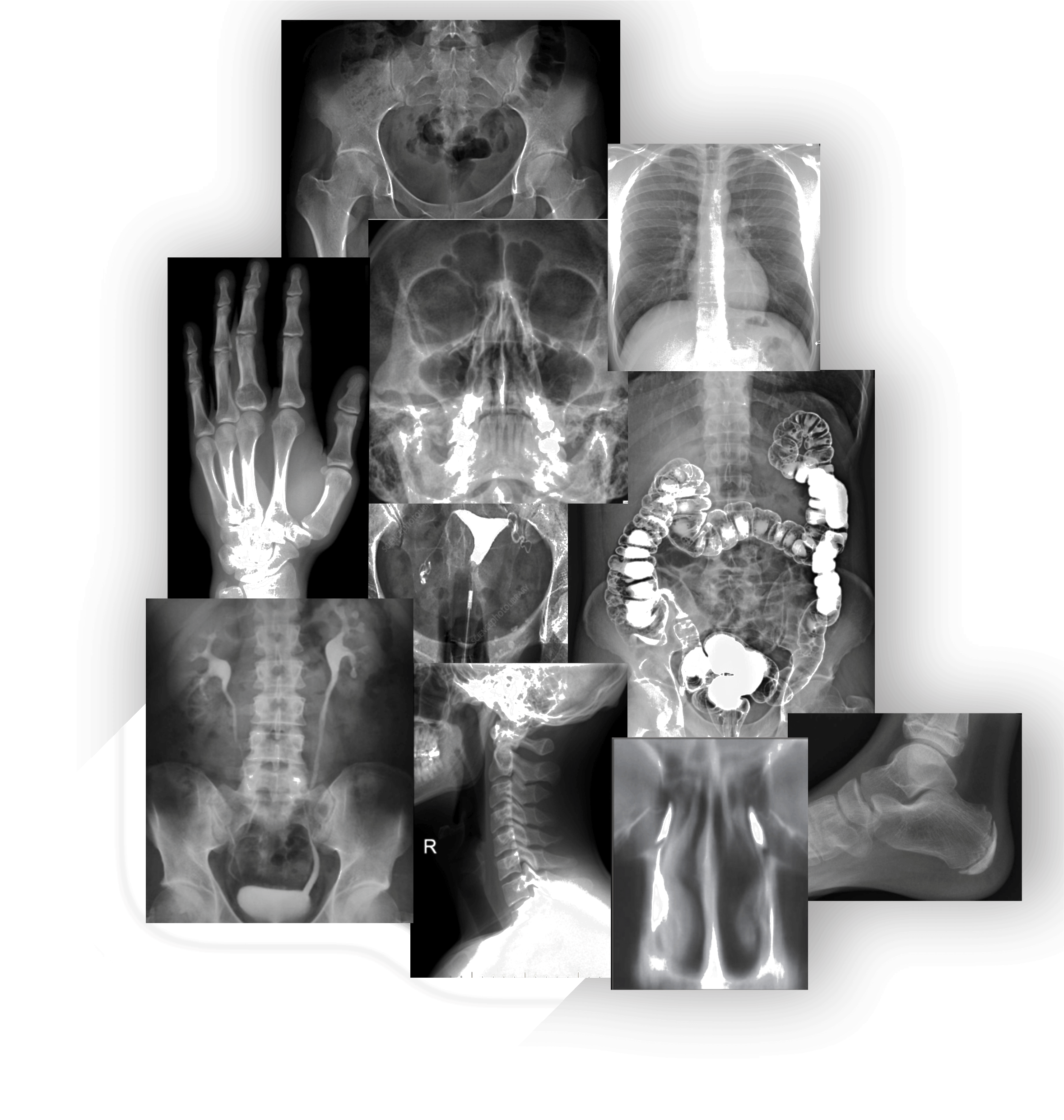 foto-mosaico-radiografia1.png